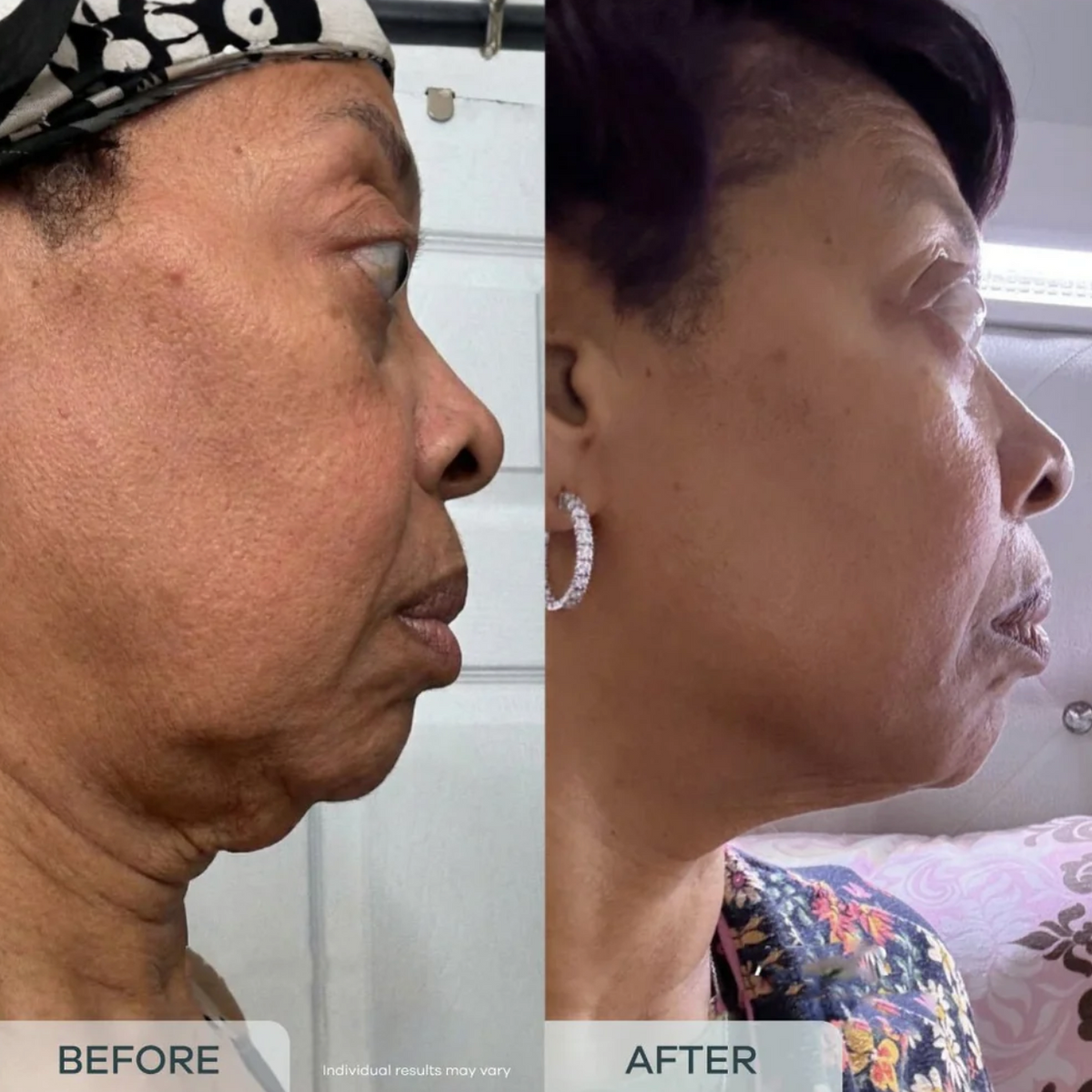 essence™ Age Reverse PDRN Serum