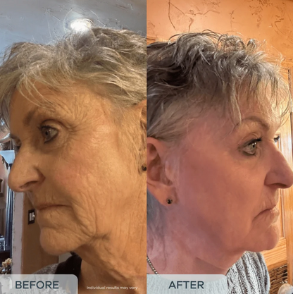 essence™ Age Reverse PDRN Serum