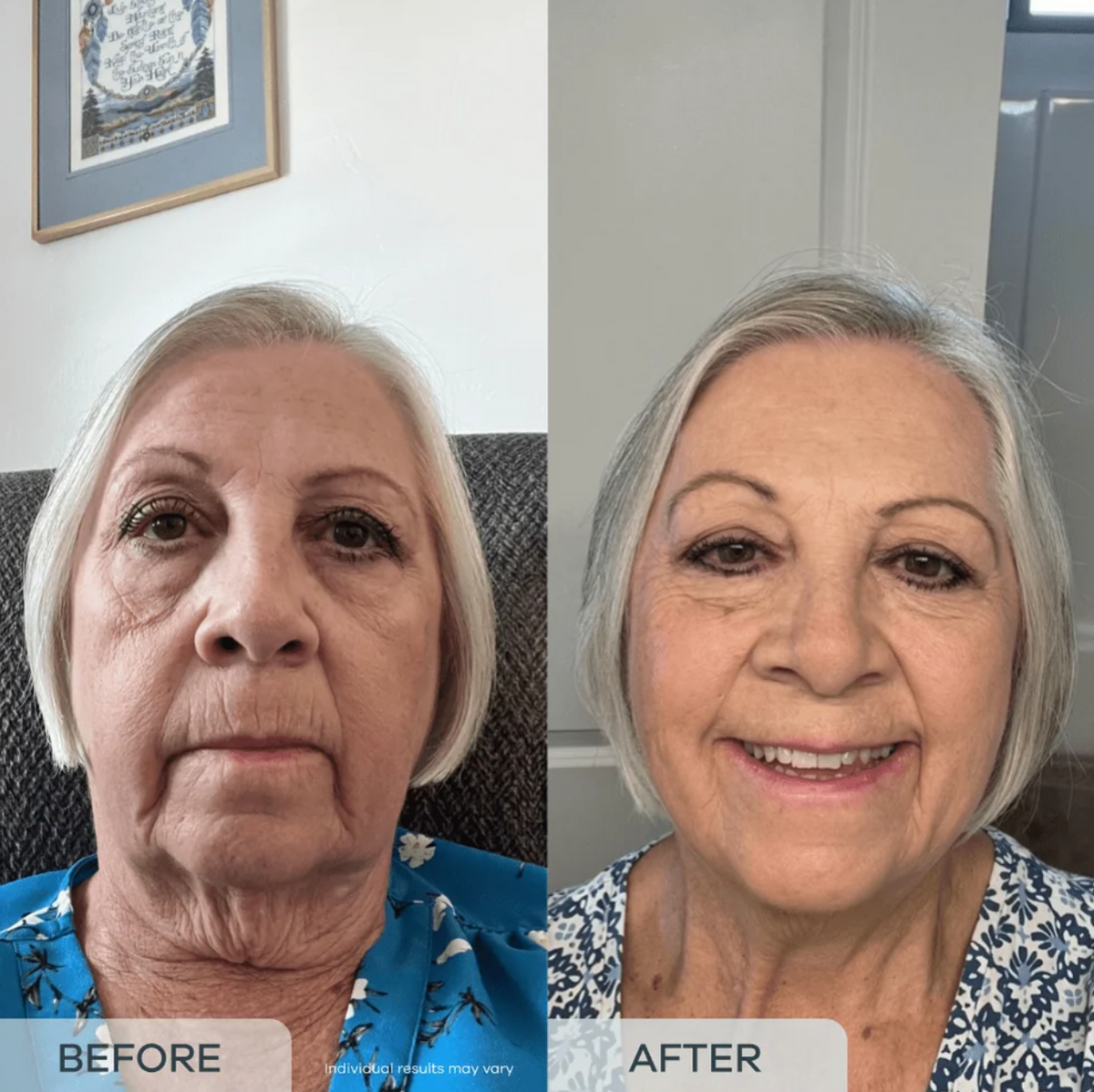essence™ Age Reverse PDRN Serum
