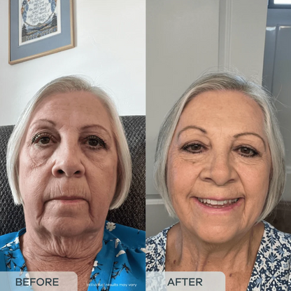 essence™ Age Reverse PDRN Serum